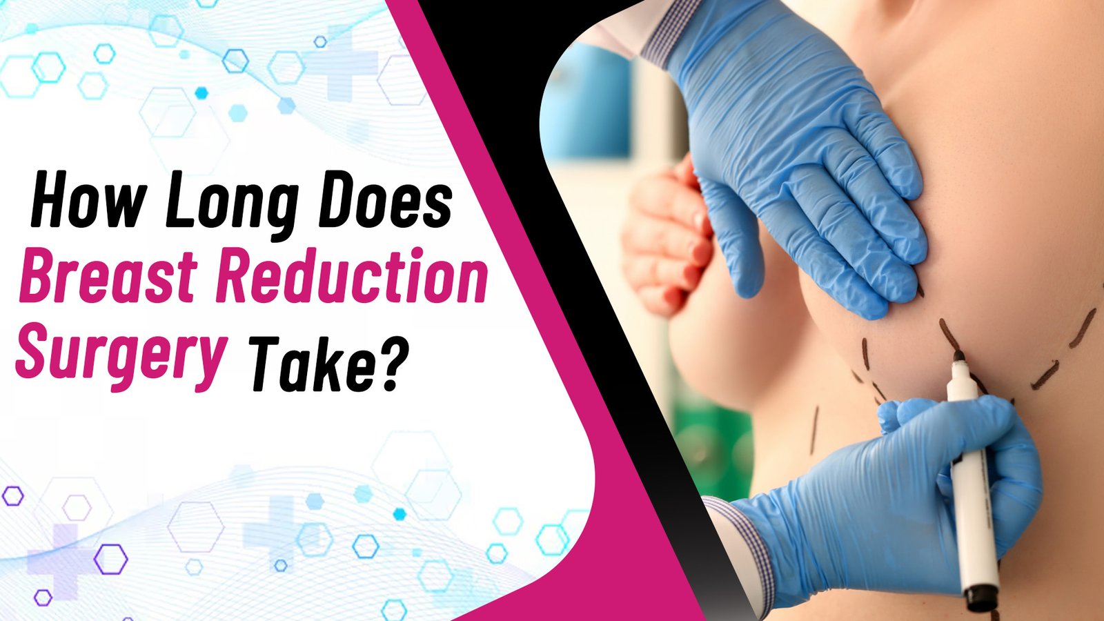 How Long Does Breast Reduction Surgery Take?