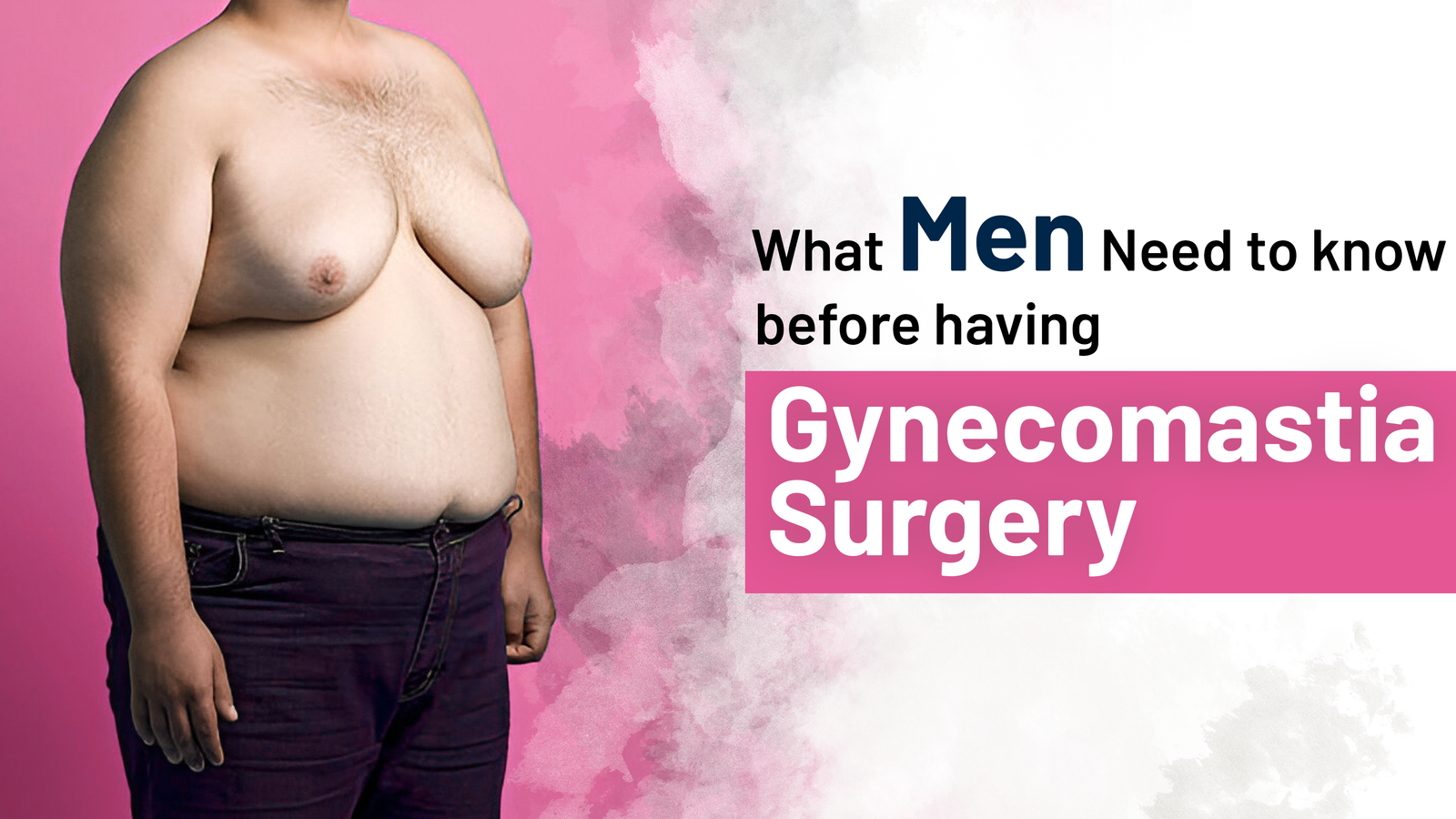 What Men Need to know before having Gynecomastia Surgery