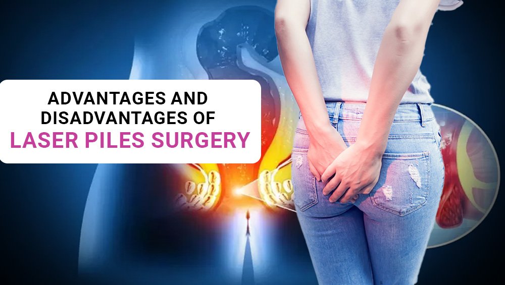 Advantages and Disadvantages of Laser Piles Surgery