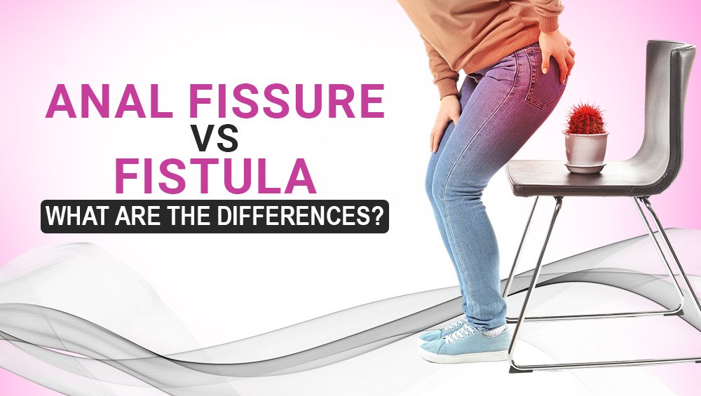 Anal Fissure vs. Fistula: What Are the Differences?