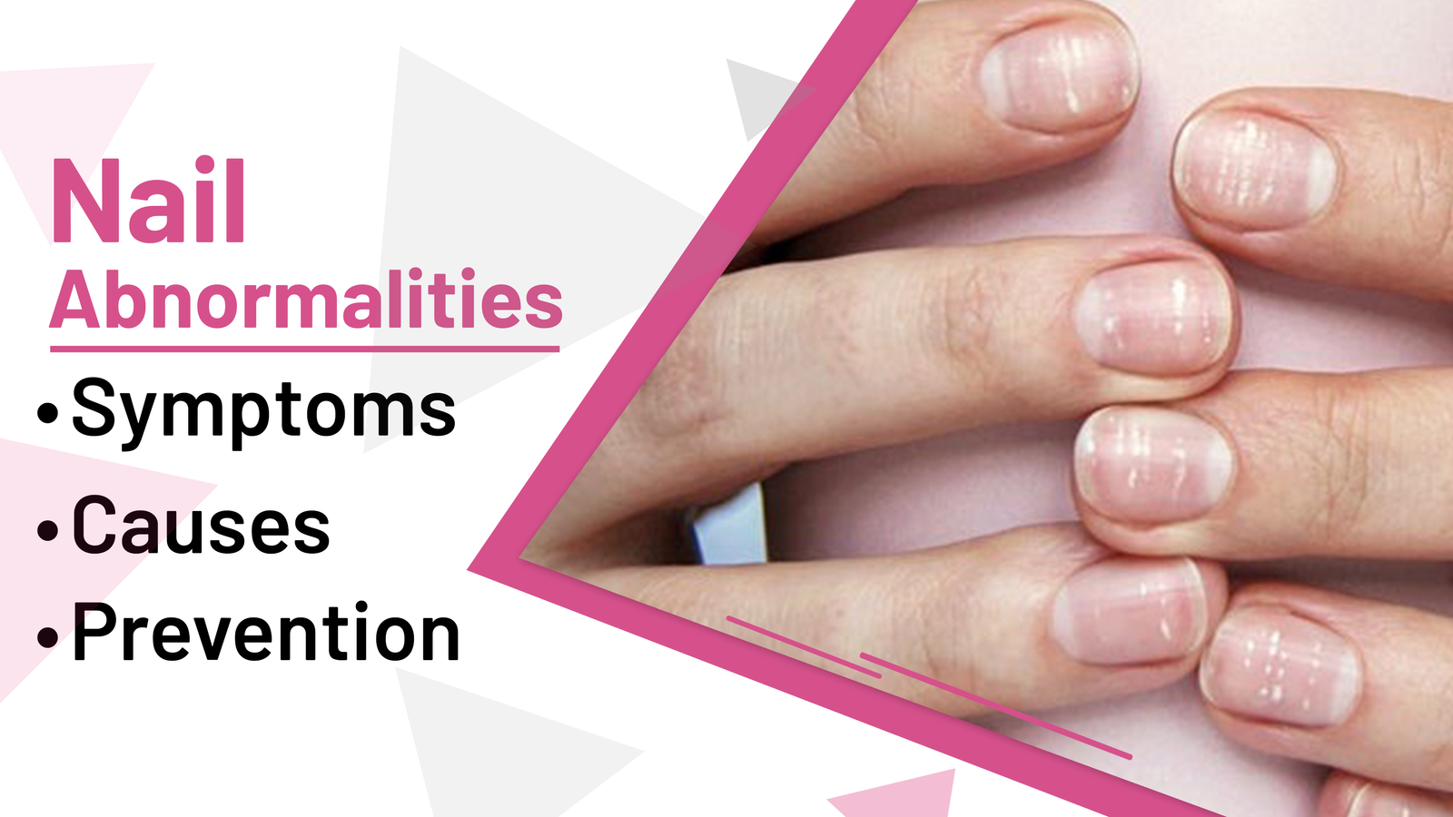 Nail Abnormalities: Symptoms, Causes, and Prevention