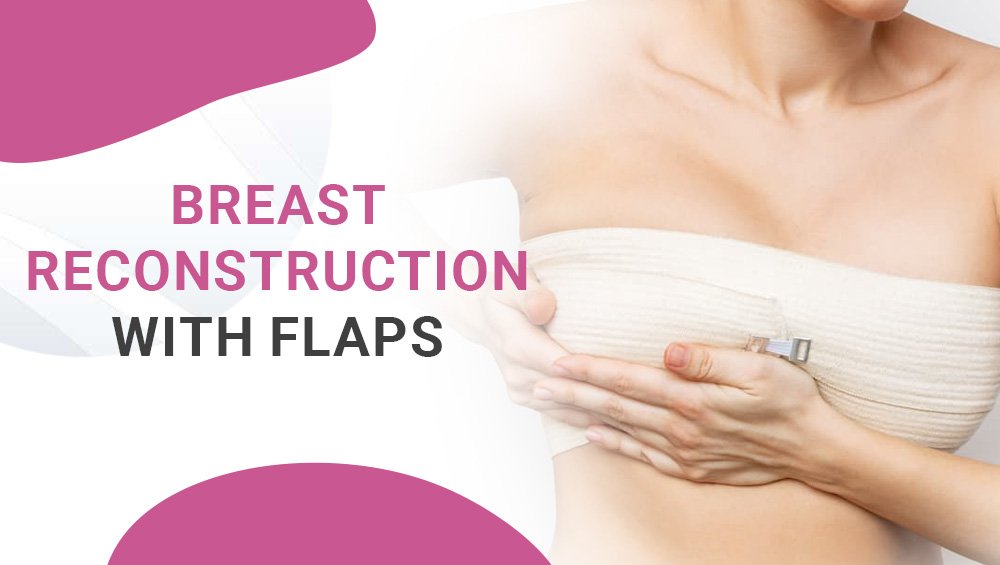 Breast Reconstruction With Flap Surgery