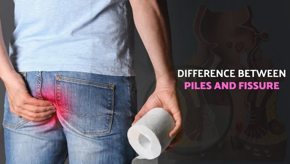 Difference Between Piles and Fissures