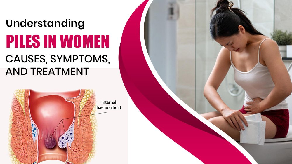 Understanding Piles in Women: Causes, Symptoms, and Treatment