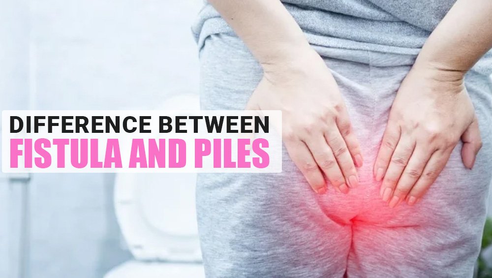 Difference Between Fistula and Piles
