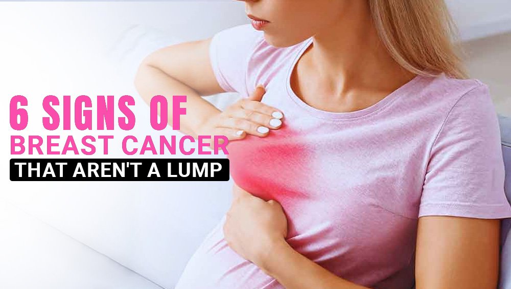 6 Signs of Breast Cancer That Aren’t a Lump