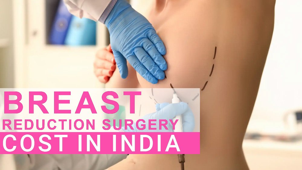 Breast Reduction Surgery Cost in India